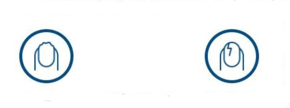 deformacija noktiju zbog gljivične infekcije